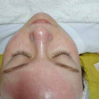 Комбинированная чистка лица
                    Косметолог Юлия Николаев