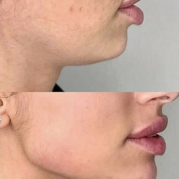 Карина Вронская, Одесса Фото - 6