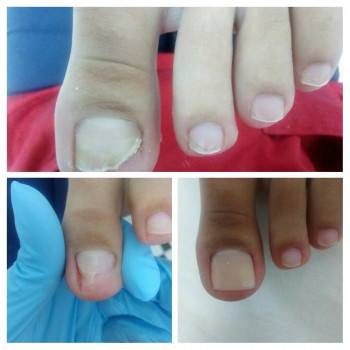 Анна Башмакова, Одеса Фото - 18