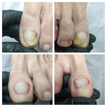 Анна Башмакова, Одеса Фото - 23