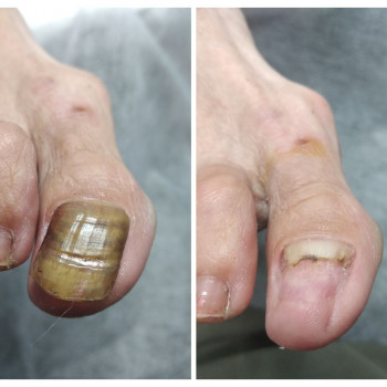 Анна Башмакова, Одеса Фото - 24