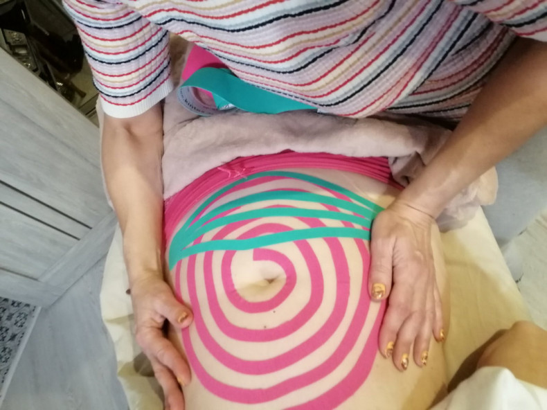 Тейпирование кинезиотейпирование живота, фото - Кинезитерапевт Рената Павлова