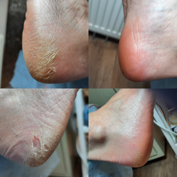 Олена Коваль, Киев Фото - 33