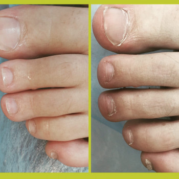 Подологічний педмкюр

    
 
 
 
 
 