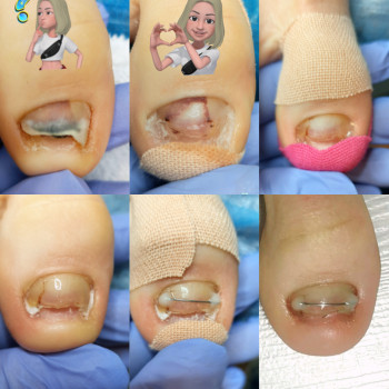 Олена Коваль, Киев Фото - 38