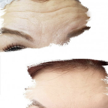 Анна Мунька, Черкассы Фото - 5