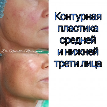 Наталия Мартыненко, Сумы Фото - 44