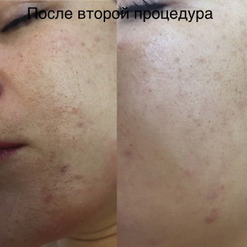 Елена Стрельчук, Житомир Фото - 12