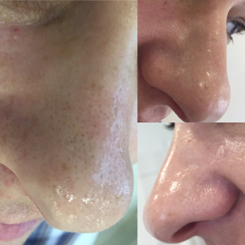 Елена Стрельчук, Житомир Фото - 16