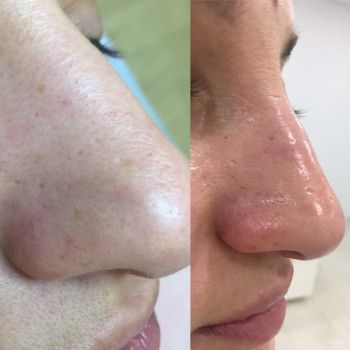 Елена Стрельчук, Житомир Фото - 19