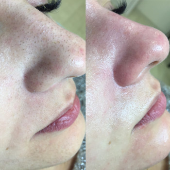 Елена Стрельчук, Житомир Фото - 31