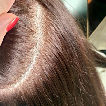 НАРАЩИВАНИЕ ВОЛОС БЕЗВРЕДНАЯ ПРОЦЕДУРА, ПРИ УСЛОВИИ реализац