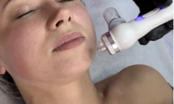 Кислородная мезотерапия Косметологічний центр O.L.Beauty Київ