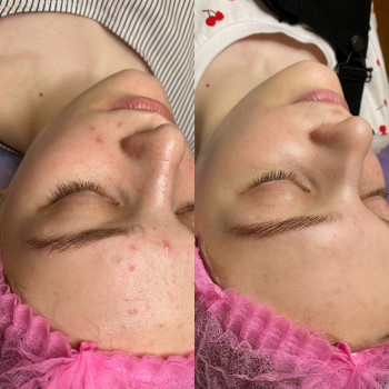 Маргарита Фоменко, Черкаси Фото - 5