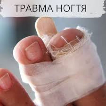 Лечение травмы ногтя