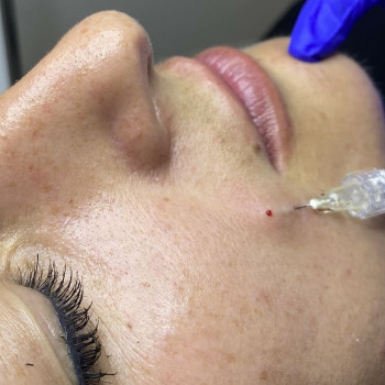 Оксана Овчинікова, Тернопіль Фото - 13