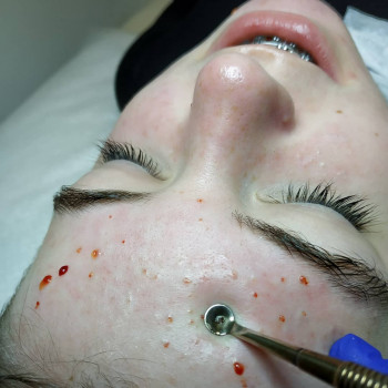 Оксана Овчинікова, Тернопіль Фото - 26