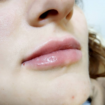 Оксана Овчинікова, Тернопіль Фото - 35