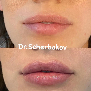 Контурная пластика лица (филлеры)
                    Косметологічний центр Нью Медикал Київ