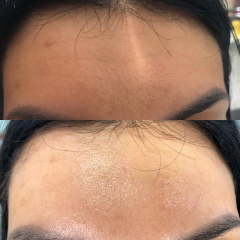 РФ-лифтинг
                    Косметологический центр Celebriti Черкассы