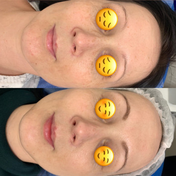 Фотоомоложение
                    Косметологічний центр Celebriti Черкаси