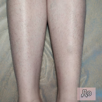 Виктория Бурова, Чернігів Фото - 5