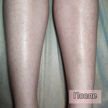 Виктория Бурова, Чернігів Фото - 6