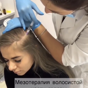 уколи ботокса для обличчя, корекціяз моршок, уколи в обличчя