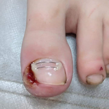 Катерина Діряба, Запоріжжя Фото - 22