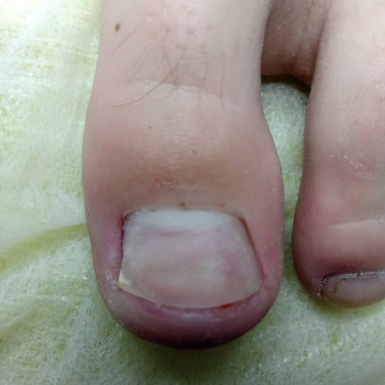 Катерина Діряба, Запоріжжя Фото - 42