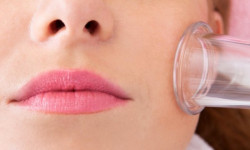 Скульптурний масаж обличчя Массажист Оксана Луцк