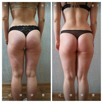 Медовий масаж
                    Массажист Оксана Луцк