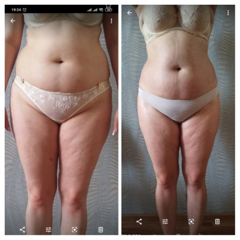 Медовий масаж
                    Массажист Оксана Луцк