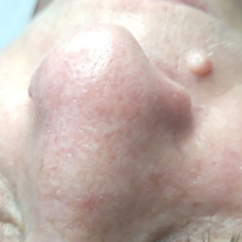 Леся Кащин, Ровно Фото - 10