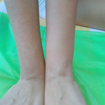 До/После Руки