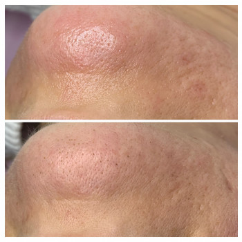 Марія Назарчук, Рівне Фото - 8