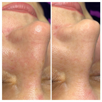 Марія Назарчук, Рівне Фото - 9