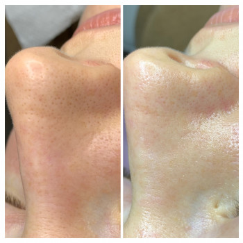 Марія Назарчук, Рівне Фото - 11