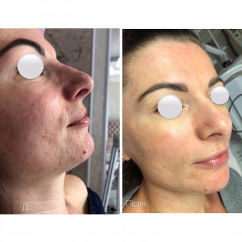 Марія Назарчук, Рівне Фото - 12