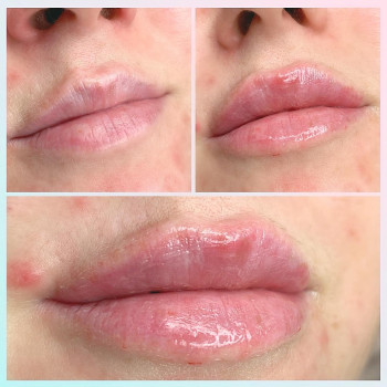 Марія Назарчук, Рівне Фото - 13