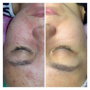 Марія Назарчук, Рівне Фото - 16