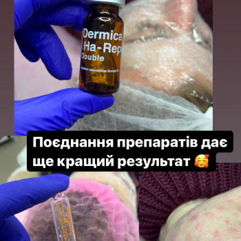 Марія Назарчук, Рівне Фото - 18