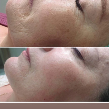 Марія Назарчук, Рівне Фото - 20