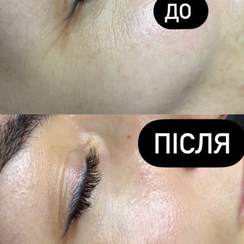 Марія Назарчук, Рівне Фото - 28