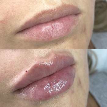 Марія Назарчук, Рівне Фото - 30