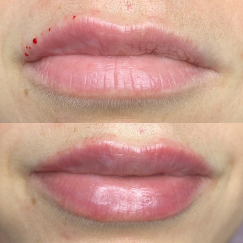 Марія Назарчук, Рівне Фото - 31