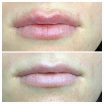 Марія Назарчук, Рівне Фото - 33