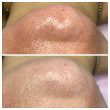 Марія Назарчук, Рівне Фото - 34