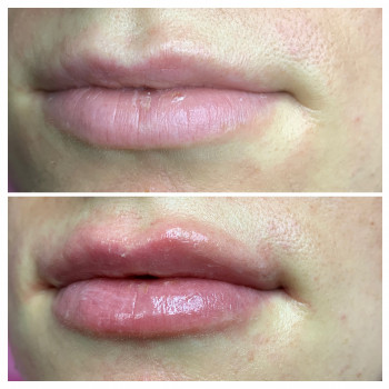 Марія Назарчук, Рівне Фото - 35