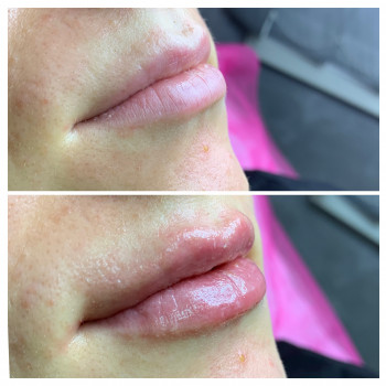 Марія Назарчук, Рівне Фото - 36